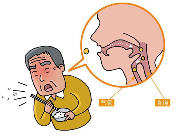 吞咽障碍漫画图片