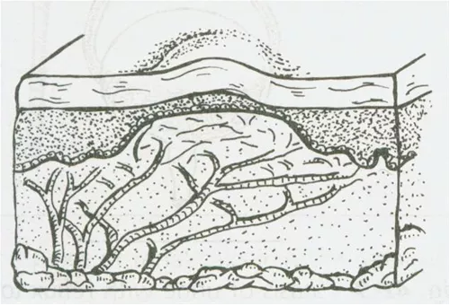 护理课堂｜老年人压疮该如何进行护理