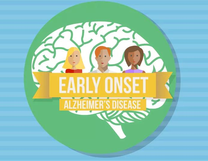 早发型阿尔茨海默病的10个症状