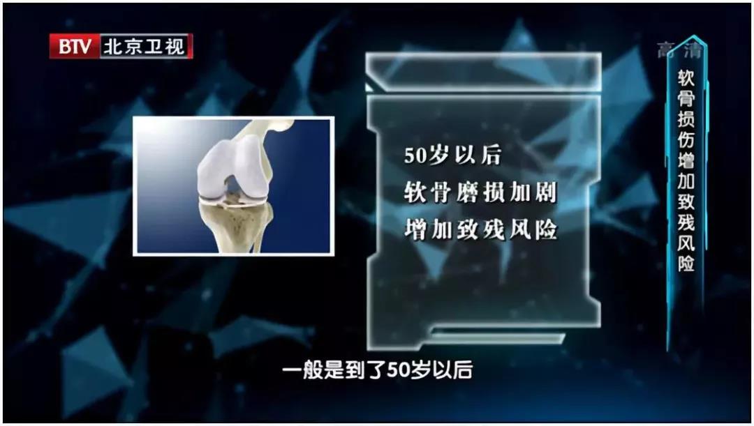 夫妻双双膝盖坏掉，竟是因为一个坚持10年的"健康习惯"