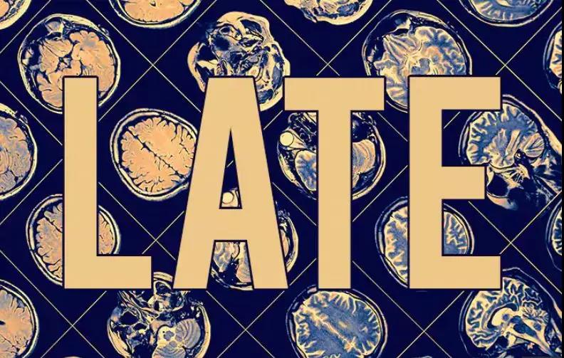 美媒：科学家发现类似阿尔茨海默病的新型认知症