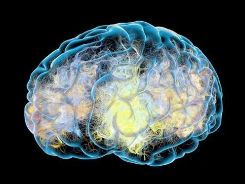 第一个阿尔茨海默病患者的故事