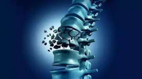 老年人摔一下真的要命!致命的不是骨折，预防和护理才是丨国德护理课（五）