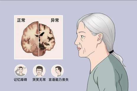 国家卫生健康委、国家中医药局：《关于组织开展2025年世界阿尔茨海默病月主题宣传活动的通知》