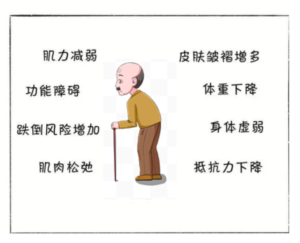 肌肉量与老年人生命健康密切相关——必须警惕的“肌少症”